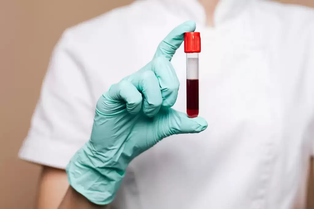 感染者的 CD4 / CD8 比率可做為罹癌風險評估的指標之一