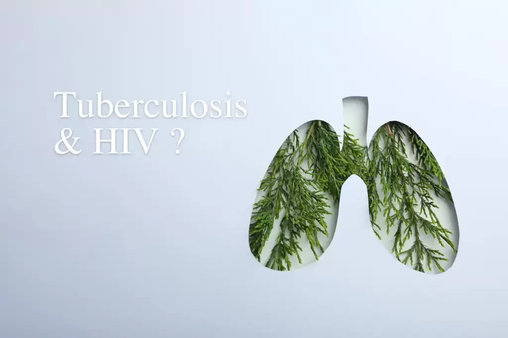 開始 HIV 藥物治療後一年內，泰國感染者「癆」病發生率非常高